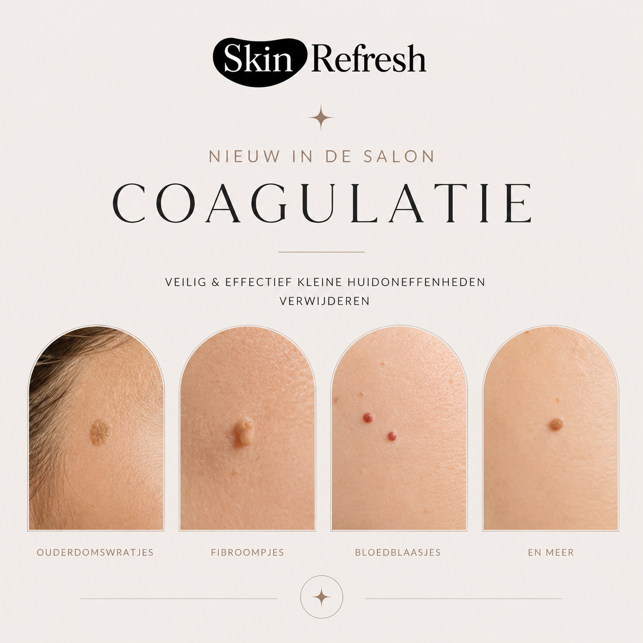 Nieuw in de salon: Coagulatie!